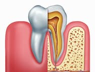 Best Endodontist in Lajpat Nagar, Delhi