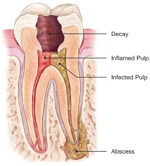 dentist (endodontist) in ashok vihar, delhi