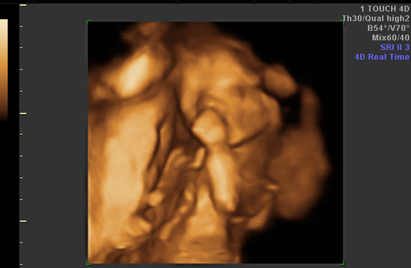 Sachdeva Diagnostics Ultrasound Images