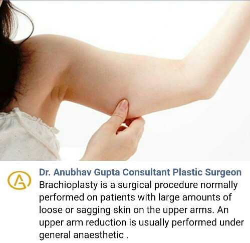 Dr Anubhav Gupta Consultant Plastic Surgeon - Brachioplasty