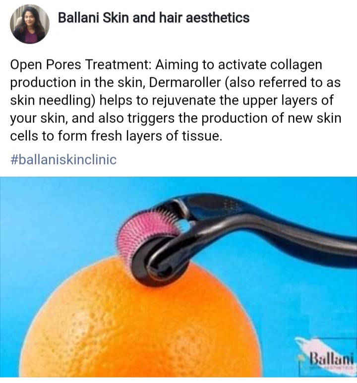Orange Peel at Ballani Skin And Hair Aesthetics
