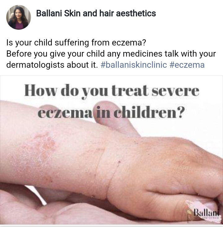 Eczema Treatment at Ballani Skin And Hair Aesthetics