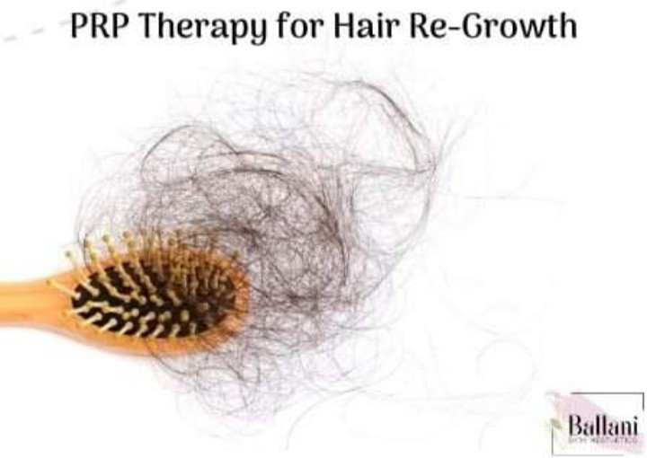 PRP Therapy For Hair Regrowth at Ballani Skin And Hair Aesthetics