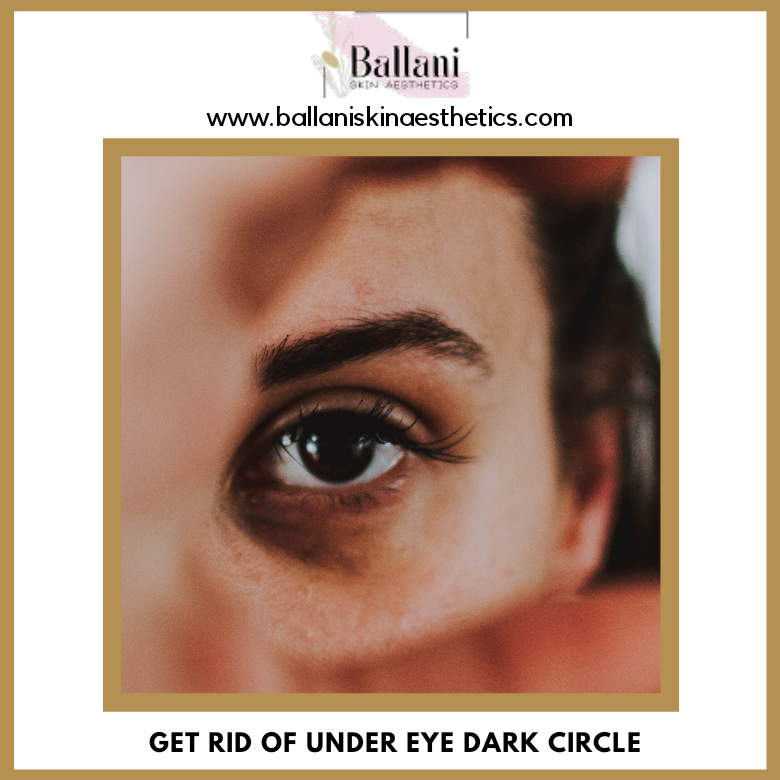 Under Eye Dark Circle Treatment in Karol Bagh