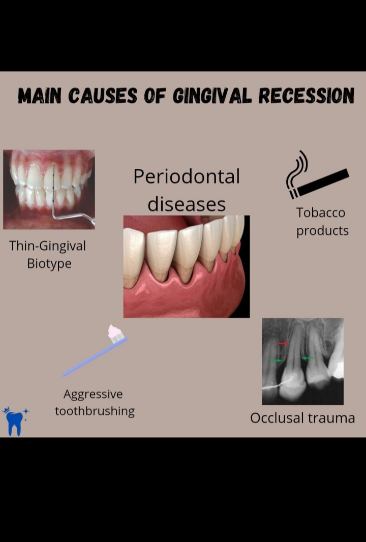 Dental Solutions - Periodontal (Gums) Treatment in Patel Nagar