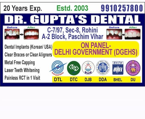 Dr Gupta Dental & Braces Clinic, Paschim Vihar - On Panel