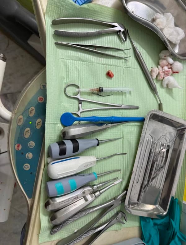 Advance Dental Treatment in vasant kunj, new delhi