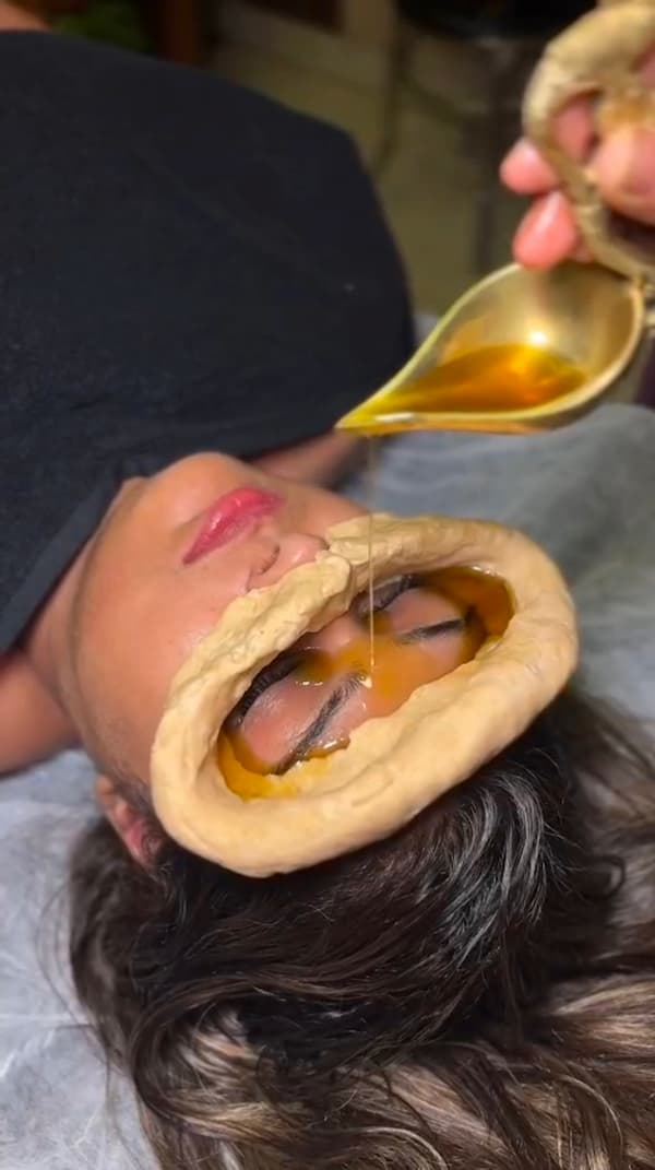 Netra Basti / Netra Tarpan therapy in rohini, delhi